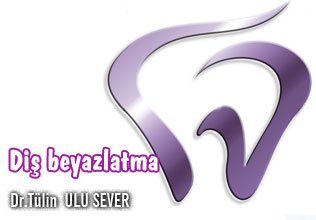Diş beyazlatma,