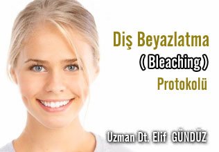 Diş beyazlatma ( bleaching ) protokolü