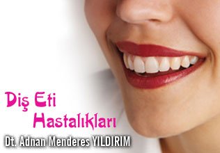 Diş eti hastalıkları