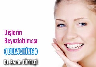Dişlerin beyazlatılması ( bleaching)