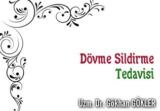 Dövme sildirme tedavisi