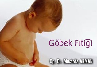 Göbek fıtığı