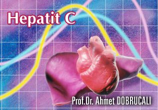 Hepatit c