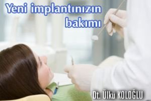 İmplantınızın bakımı