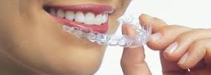 Invisalign ile tedavi