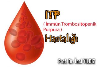 İtp immün trombositopenik purpura hastalığı