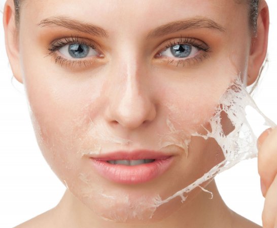 Kimyasal peeling nedir, neden yapılır ?