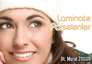 Laminate porselenler