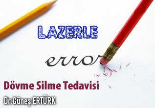 Lazerle dövme silme tedavisi