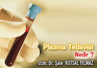 Plazma tedavisi nedir ?