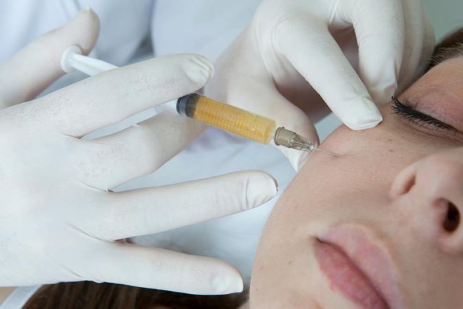 Prp (platelet rich plasma),