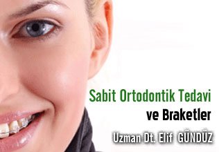 Sabit ortodontik tedavi ve braketler