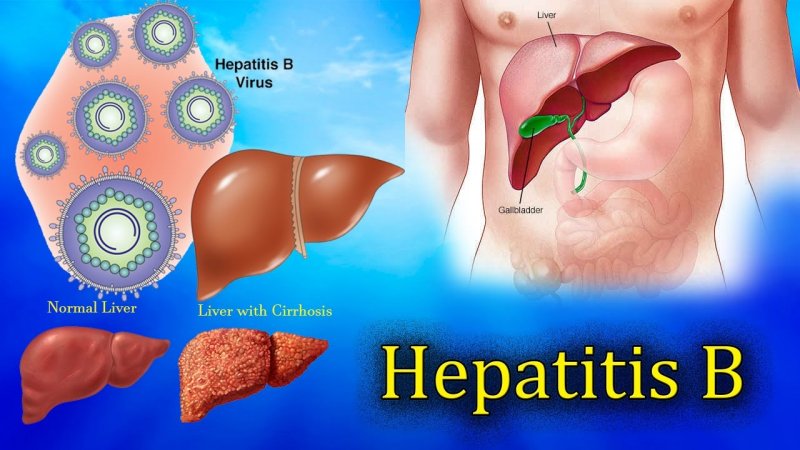 Sinsi bir hastalık hepatitler siz de hepatit hastası mısınız?