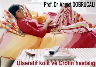 Ülseratif kolit ve crohn hastalığı hakkında